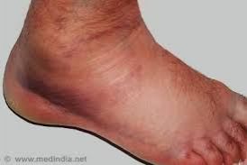 ankle